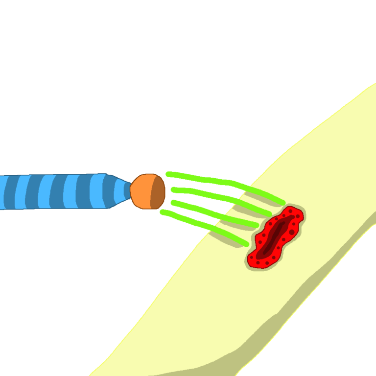A blue striped wand with a red orb is sending green lines to an open wound on an arm. The green lines are meant to heal the wound. This is an example of regenerative magic, another style of fantasy magic.
